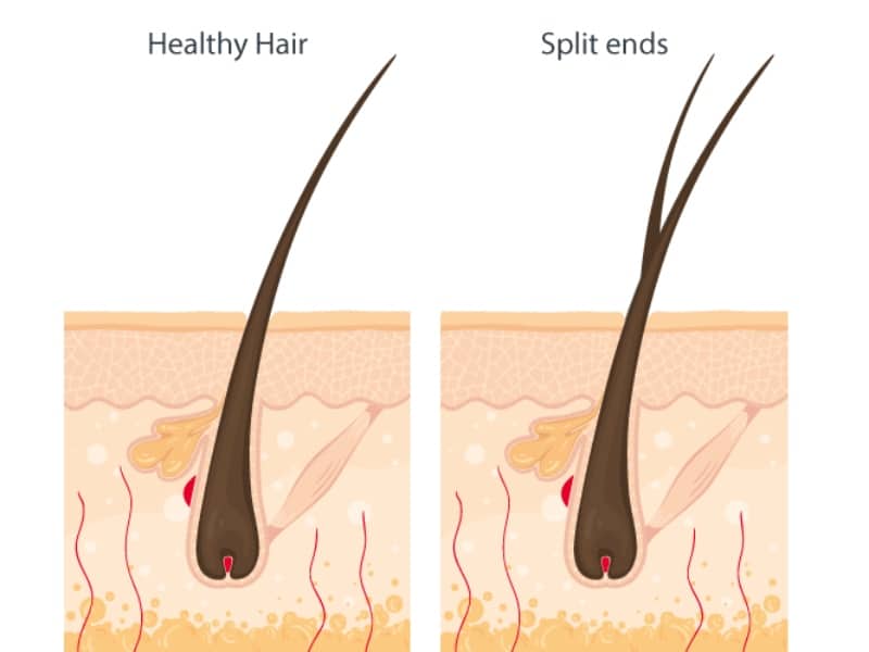 7 Awesome Remedies For Split End Hairs at Home